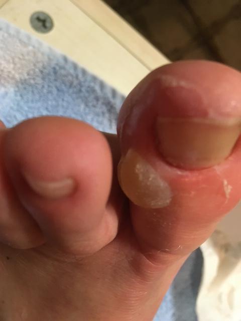 17.3. Das Fussprojekt